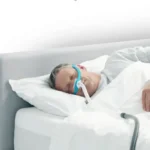 Sleep Apnea